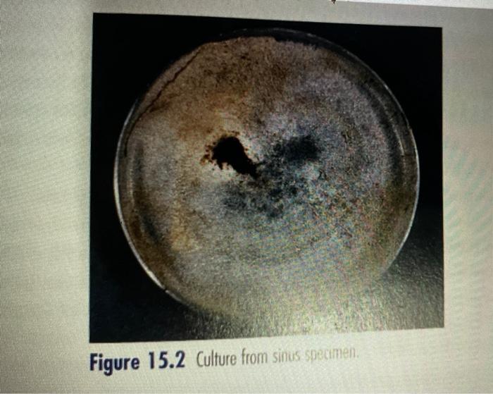 Solved Case 15 This 62-year old man presented with a 4-day | Chegg.com