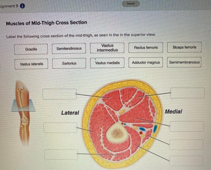 Solved Saved Eignment 9 € Muscles of Mid-Thigh Cross Section | Chegg.com