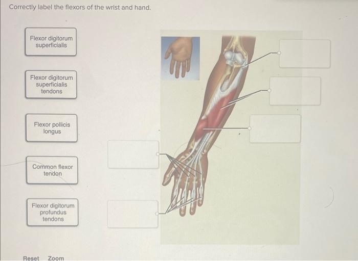 Solved Correctly label the flexors of the wrist and