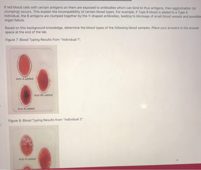 Solved Activity 4: Blood Typing Q15: What Is The Blood Type | Chegg.com