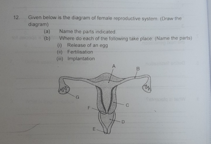 Solved Given below is the diagram of female reproductive | Chegg.com