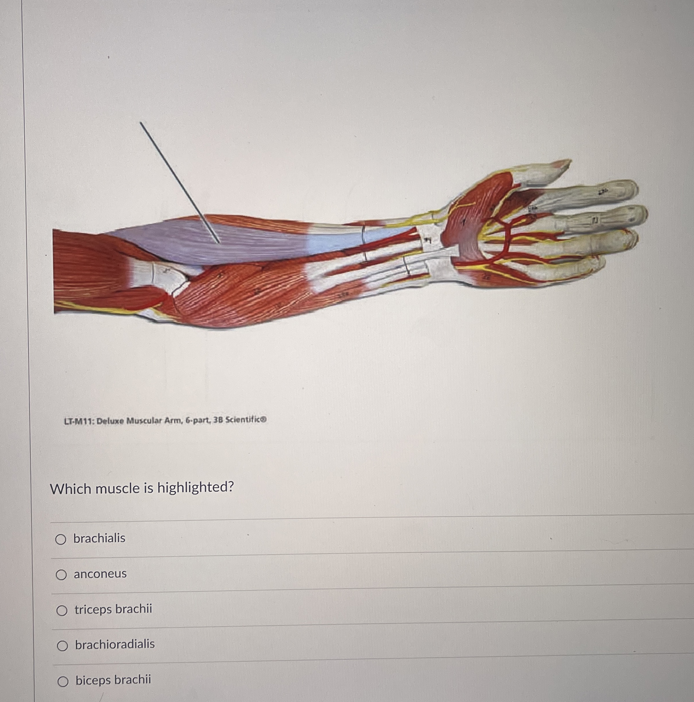 Solved LT-M11: Deluxe Muscular Arm, 6.part, 38 | Chegg.com
