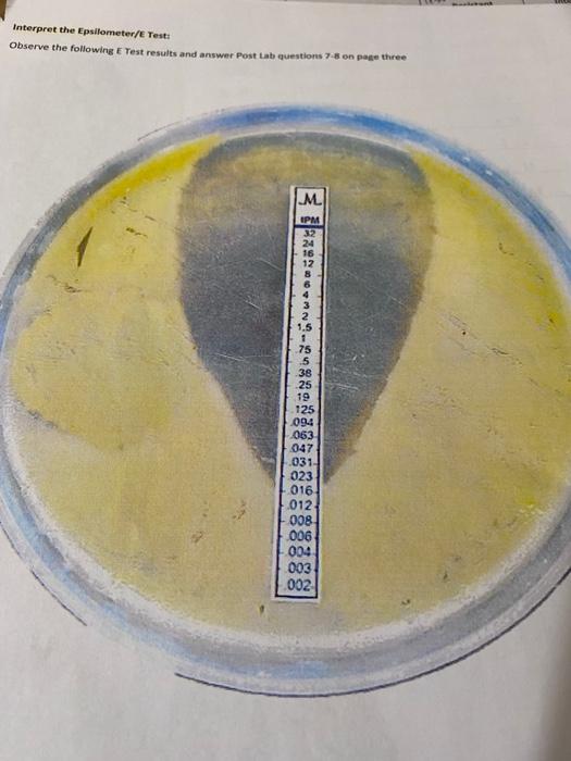 Solved What antibiotic measurement /value does rhe E test