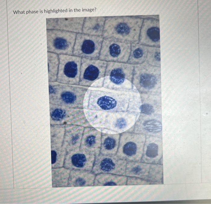 Solved What phase is highlighted in the image? interphase | Chegg.com