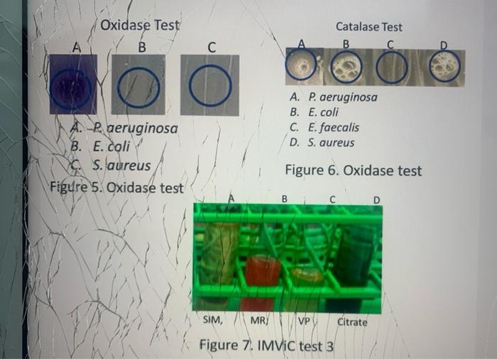 Solved IMVIC Test - Organism A Urease Test E. Coli P. | Chegg.com