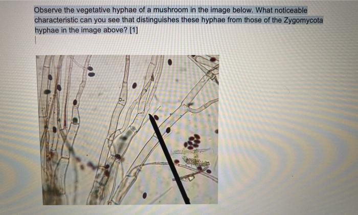 Solved Observe the vegetative hyphae of a mushroom in the | Chegg.com