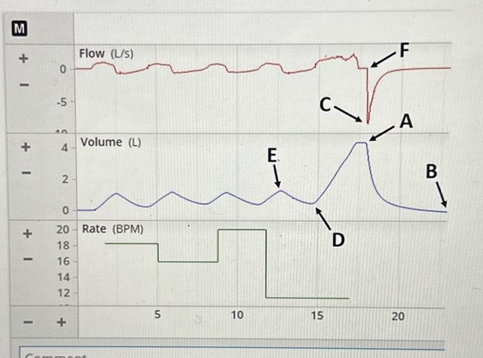 Solved In the figure above, to measure the inspiratory