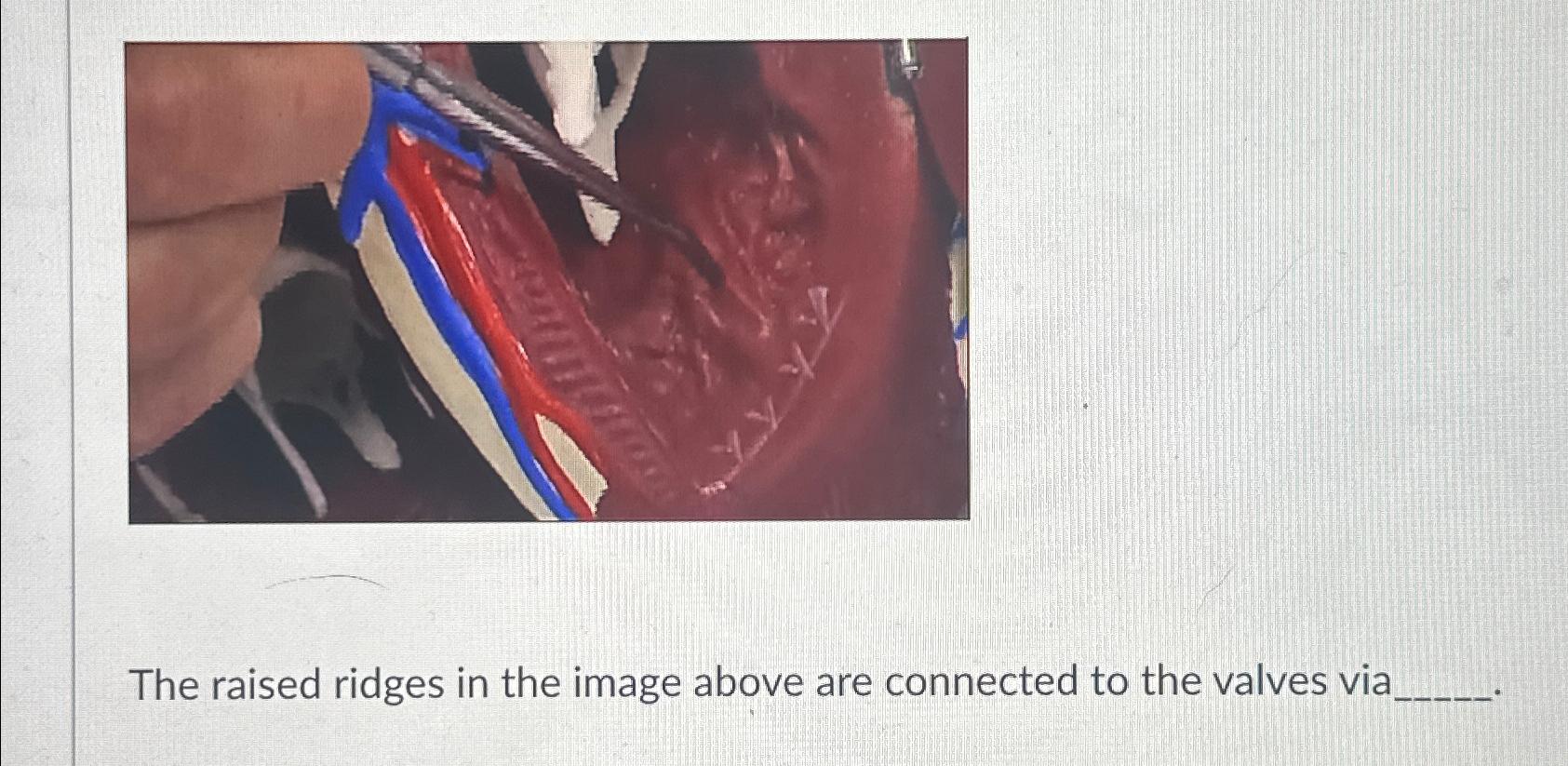 Solved The raised ridges in the image above are connected to | Chegg.com