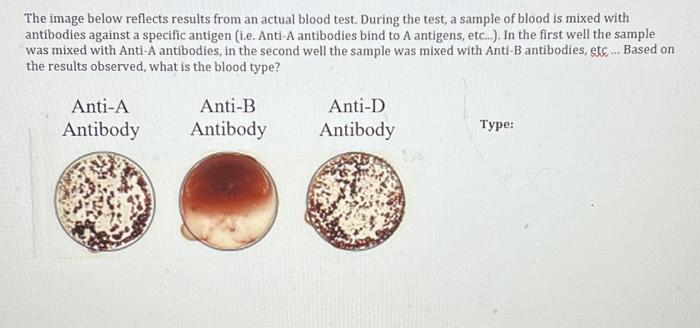 Solved Anatomy And Physiology II Blood Typing Directions: | Chegg.com