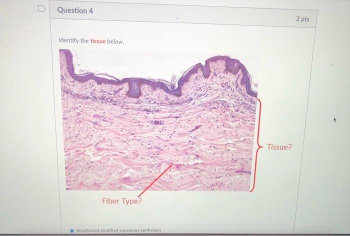 Question 4 2 pts Identify the tissue below. Tissue? Fiber Type? Keratinized stratified samas eithelium