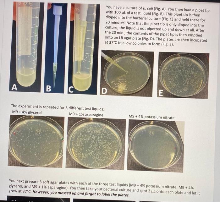 e coli liquid culture 