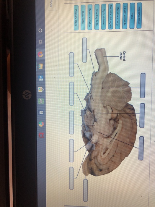 Solved Hypothalamus Fourth ventide Central Mamillary body | Chegg.com