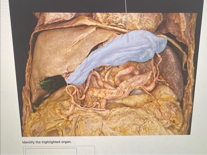 Identify the highlighted organ.