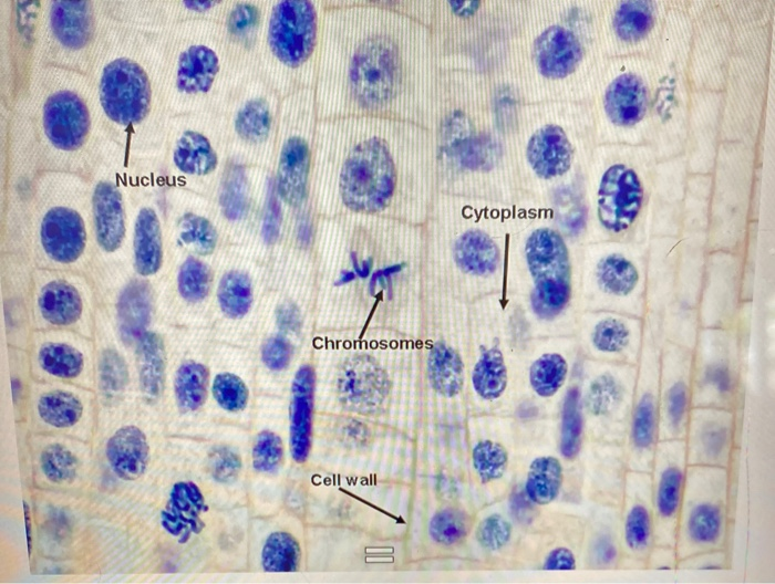 EXPERIMENT 1: OBSERVATION OF MITOSIS IN A PLANT CELL | Chegg.com