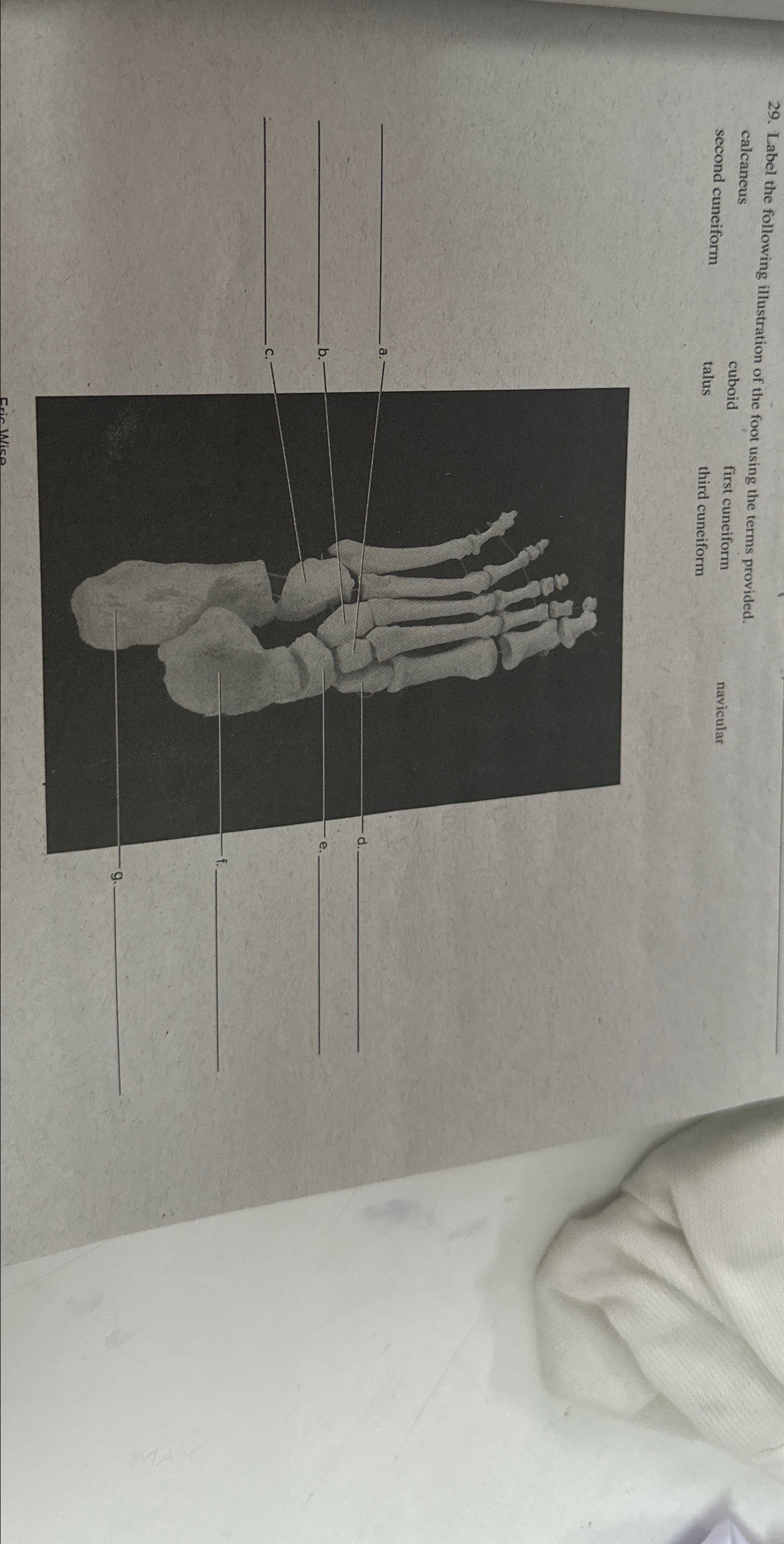 Solved Label the following illustration of the foot using | Chegg.com