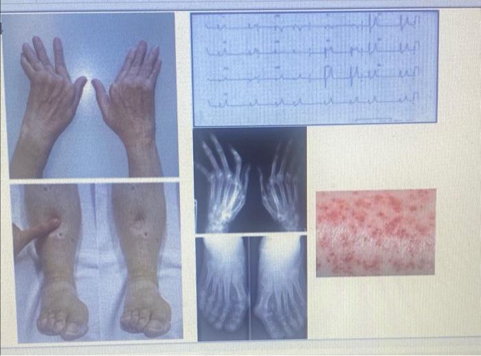 Solved Case Studies Part 2 CASE STUDY 4 A 68-year-old female | Chegg.com