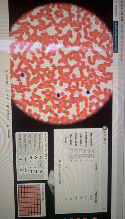 Solved BLOOD. DIFFERENTIAL WHITE BLOOD CELL COUNT | Chegg.com