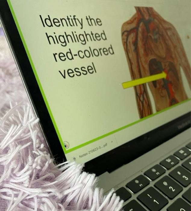 Solved Identify The Highlighted Red-colored Vessel | Chegg.com