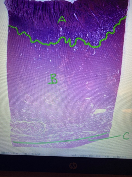 Solved what organ is pictured and name zones labeled a b and | Chegg.com