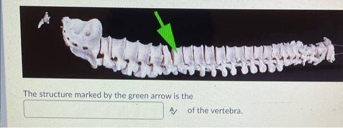 Solved The part of the vertebra marked by the green arrow is | Chegg.com