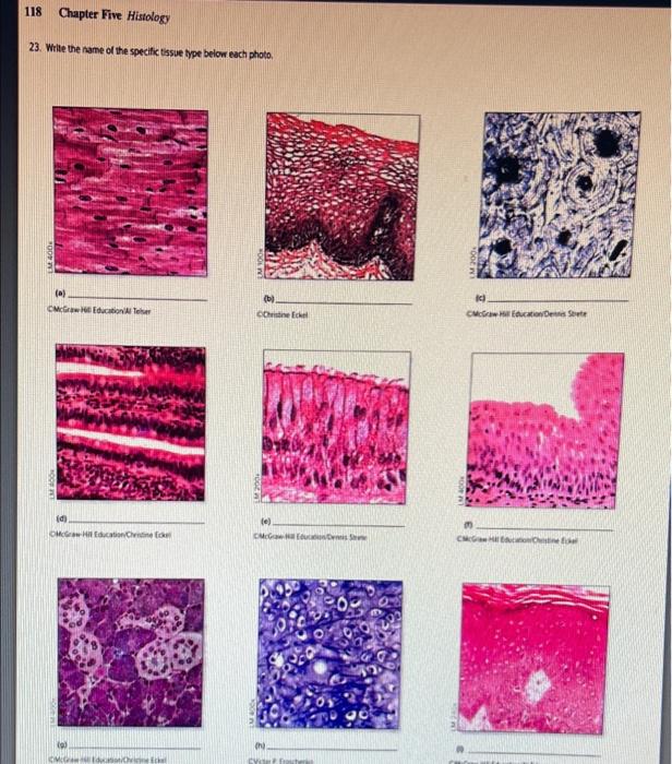 Solved Write The Name Of The Specific Tissue Type Below In | Chegg.com