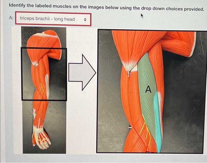 Solved Identify the labeled muscles on the images below | Chegg.com