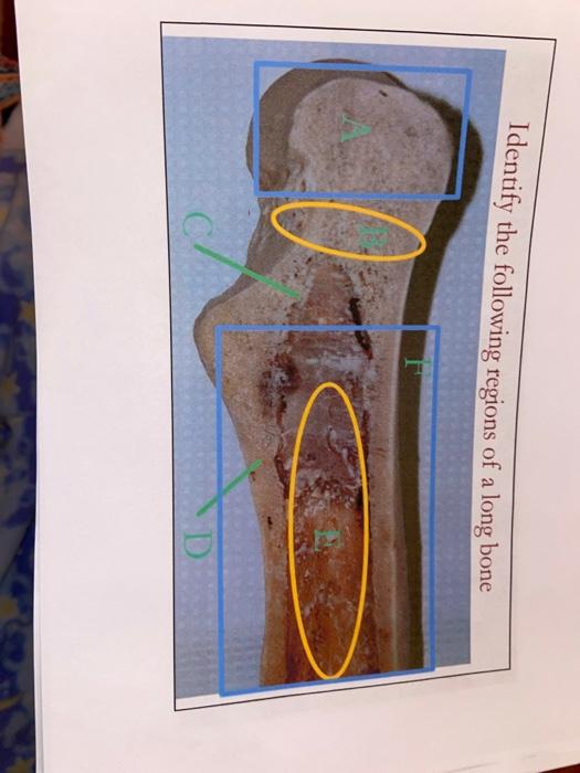 Solved Identify the following regions of a long bone D | Chegg.com