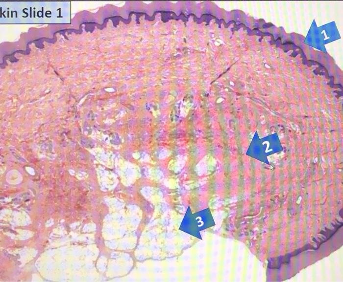 Solved SKIN SLIDE #1: 1. Name this layer. Name the tissue of | Chegg.com