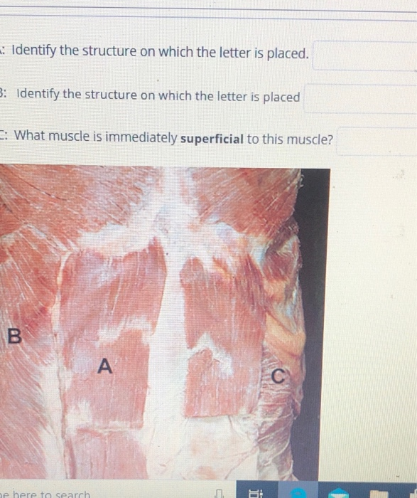 Solved : Identify the structure on which the letter is | Chegg.com