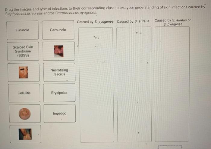 Drag the images and type of infections to their | Chegg.com