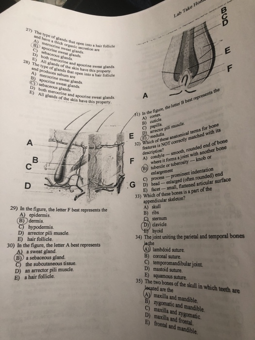 Solved Lab Take Ho 27 The Type Of Glands That Open Into