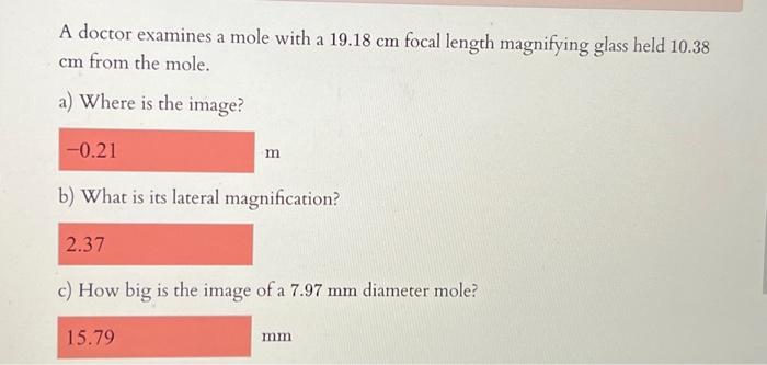 Solved A doctor examines a mole with a 19.18 cm focal length | Chegg.com
