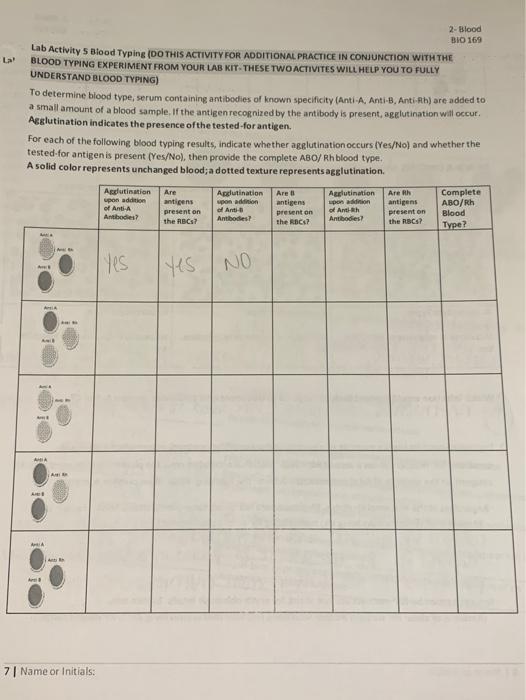 Solved La 2 Blood BIO 169 Lab Activity 5 Blood Typing DO Chegg