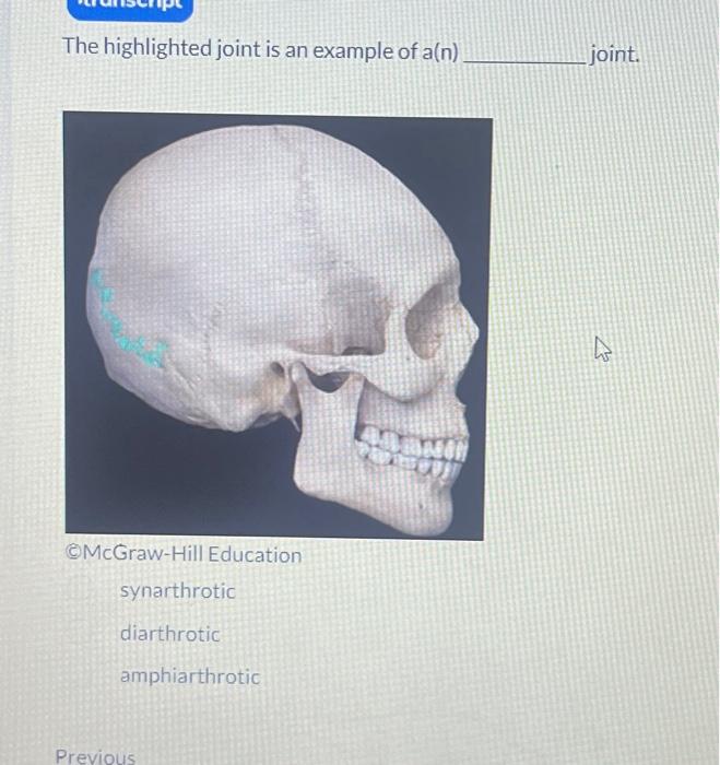 Solved The highlighted joint is an example of a(n) joint. | Chegg.com