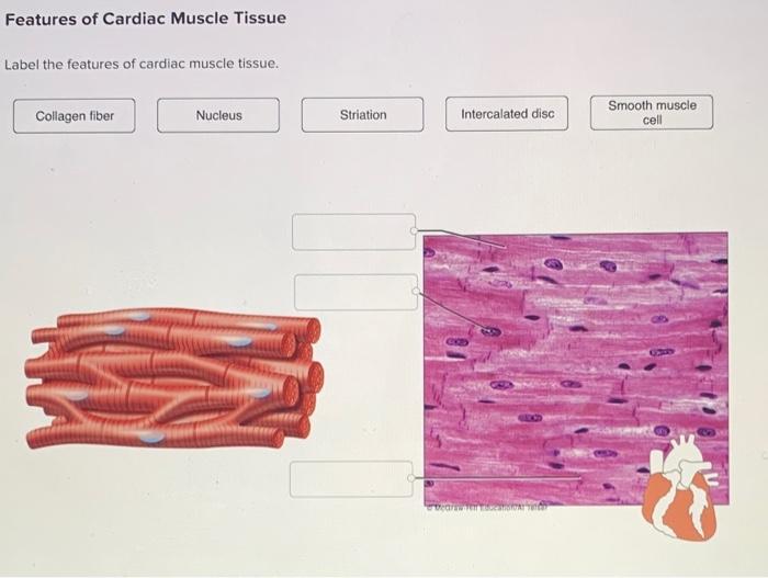 cardiac muscle cell labeled