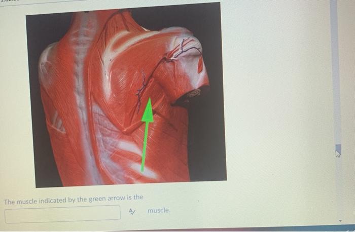The muscle indicated by the green arrow is the A/ muscle