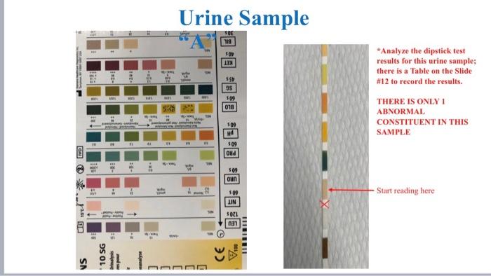 Urine Sample SOY 13X *Analyze the dipstick test results for this urine sample; there is a Table on the Slide #12 to record th