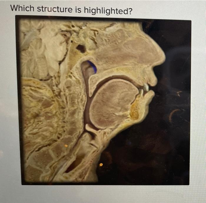 solved-which-structure-is-highlighted-which-structure-is-chegg