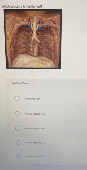 Which structure is highlighted?
Multiple Choice
subclavian vein
internal jugular vein
external jugular vein
brachiocephalic v