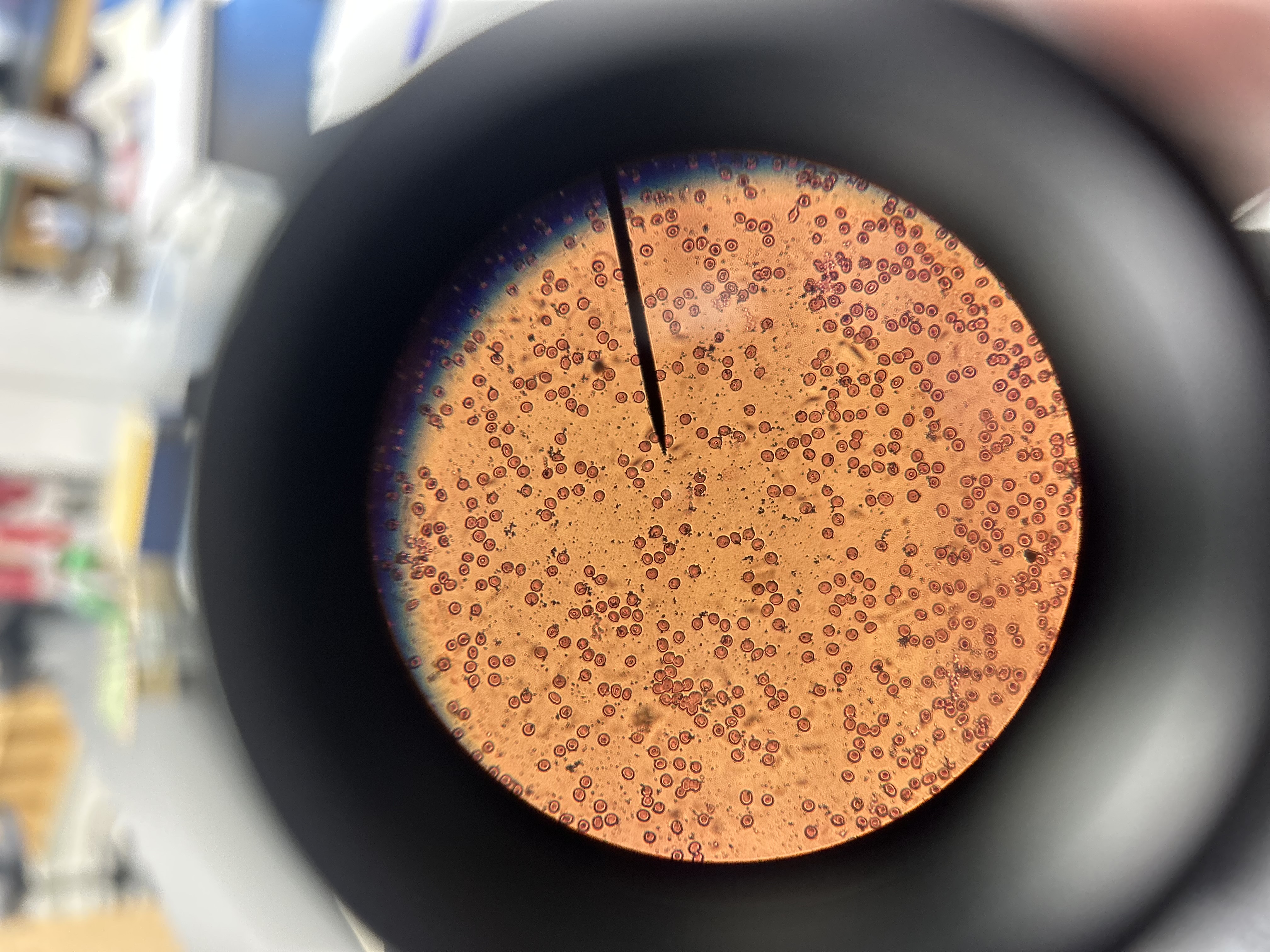 Solved Describe your blood smear. Cells present and cell | Chegg.com