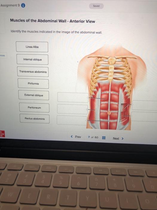 Solved Assignment 9 Seved Muscles of the Abdominal Wall - | Chegg.com