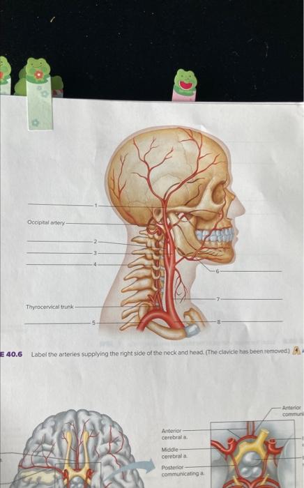 label the arteries supplying the right side of the neck and head