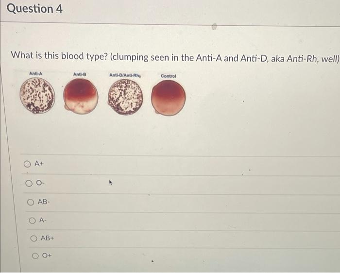 solved-question-4-what-is-this-blood-type-clumping-seen-in-chegg