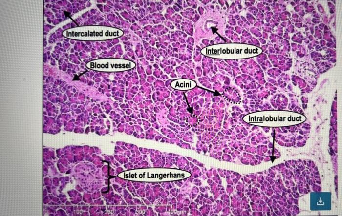 Solved Examining The Microscopic Structure Of The Pancreas Chegg