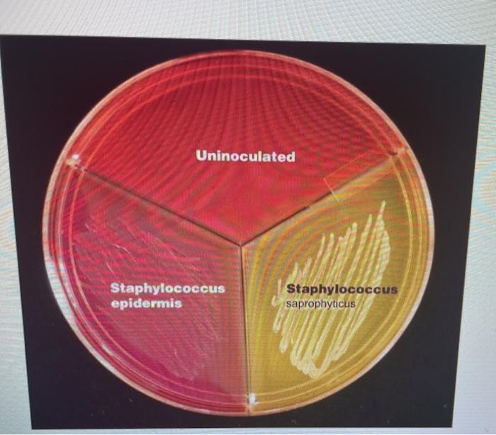 Staphylococcus Saprophyticus