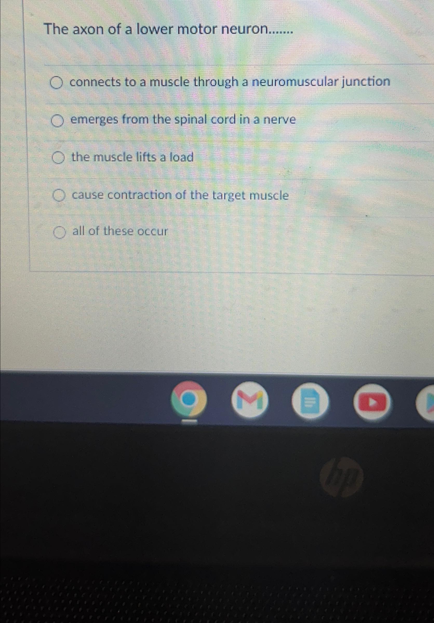 Solved The axon of a lower motor neuron.......connects to a | Chegg.com