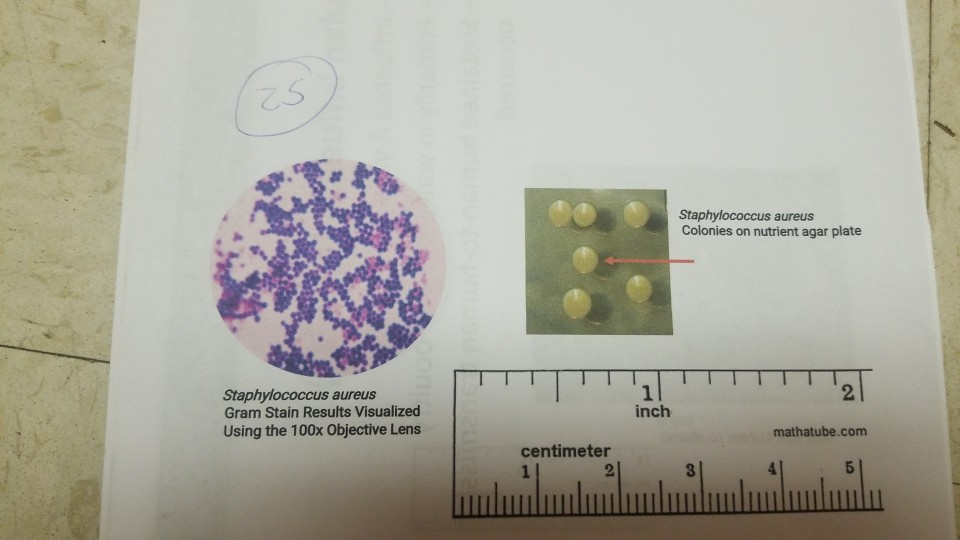 Solved Part I Observe The Gram Stain Results And Colonie Chegg Com