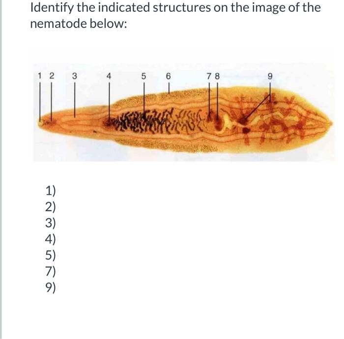 Solved Identify The Indicated Structures On The Image Of The Chegg Com