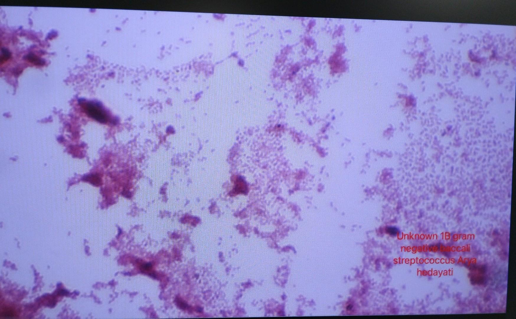 Based on the results of your Gram stain, which of | Chegg.com