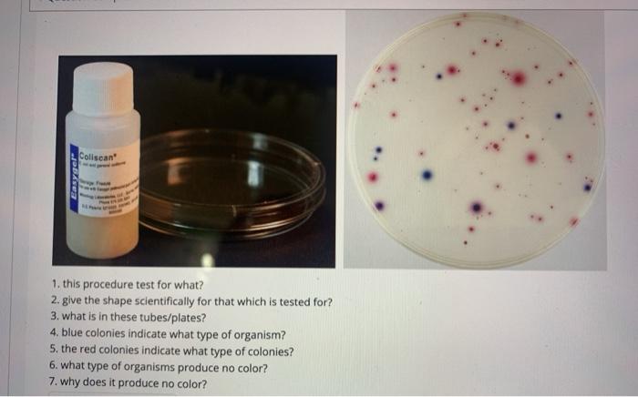 Solved Collscan Easygel 1. this procedure test for what? 2. | Chegg.com